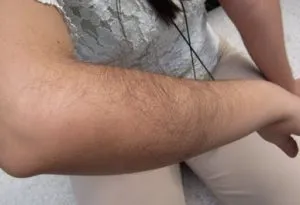 hairy forearms hairy forearms