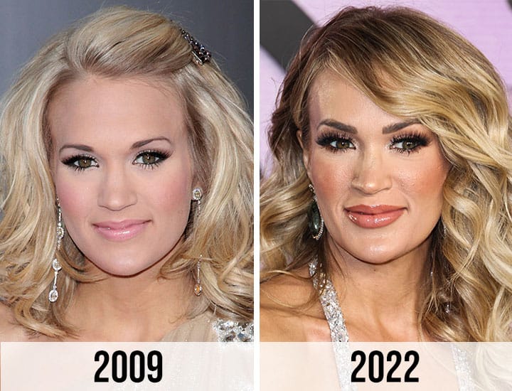 Comparison photos of Carrie Underwood's face in 2009 vs. her appearance in 2022