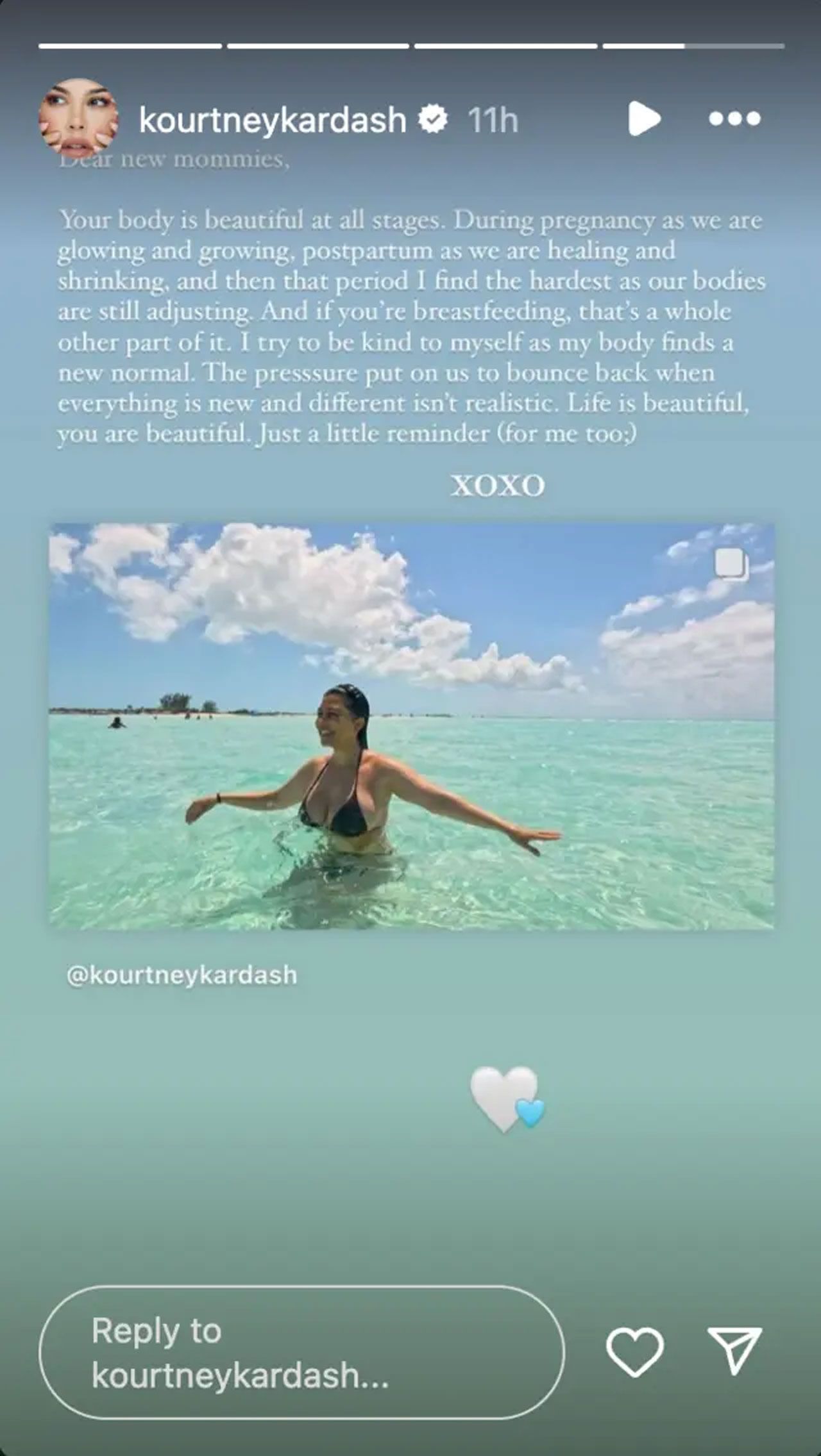 Kourtney Kardashian postpartum body Instagram Story