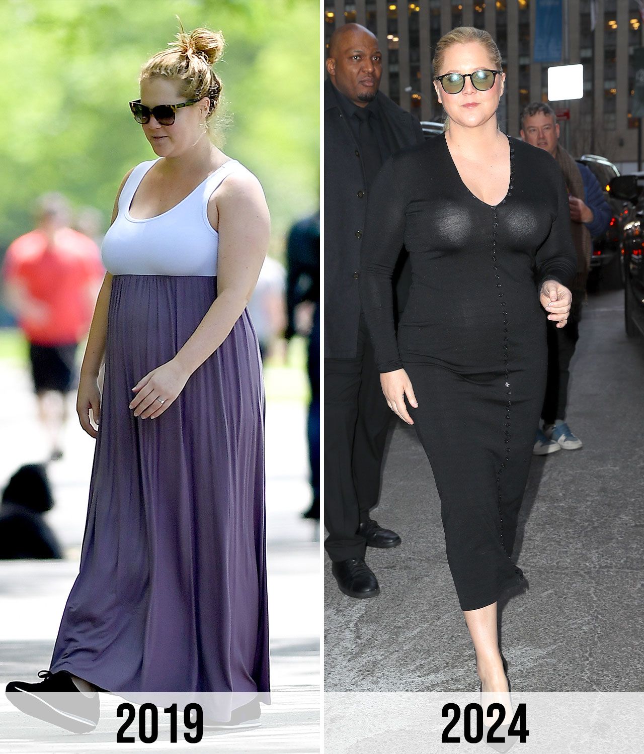 Before and After Amy Schumer Photos