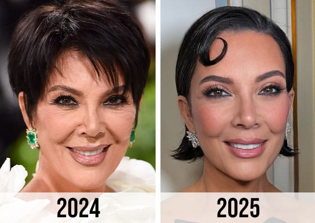 Kris Jenner before and after