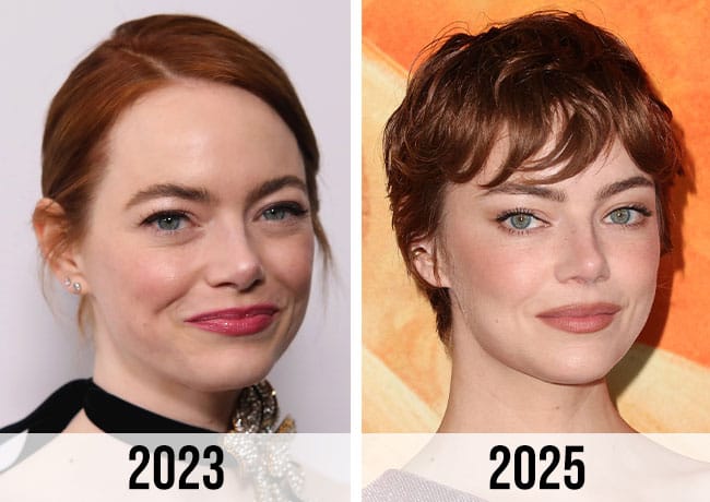 emma stone plastic surgery
