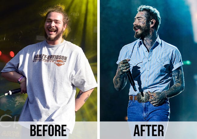 Post Malone weight loss before and after