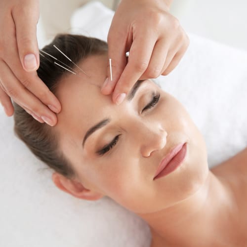 acupuncture