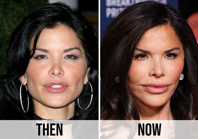 lauren sanchez plastic surgery