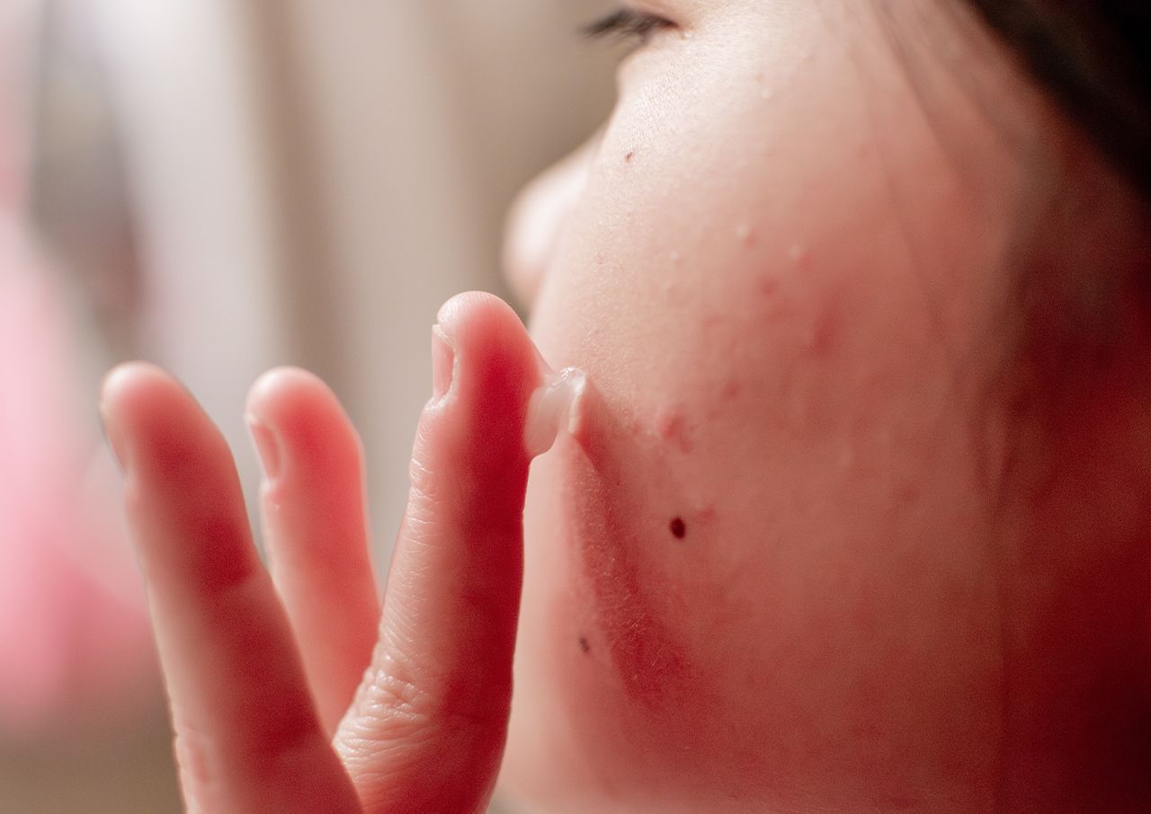 not-prepping-skin