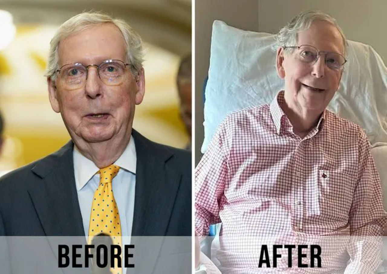 Mitch McConnell before and after