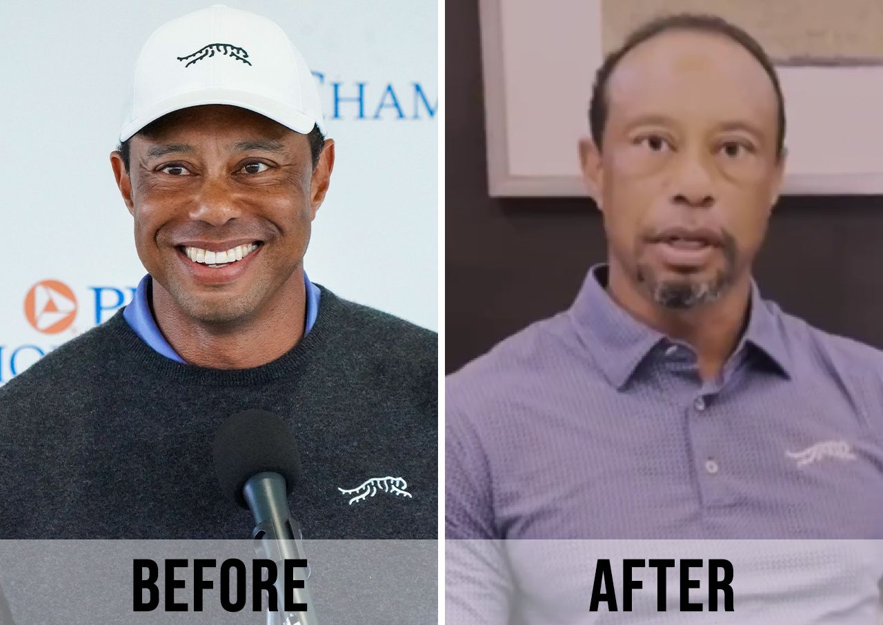 tiger woods before and after