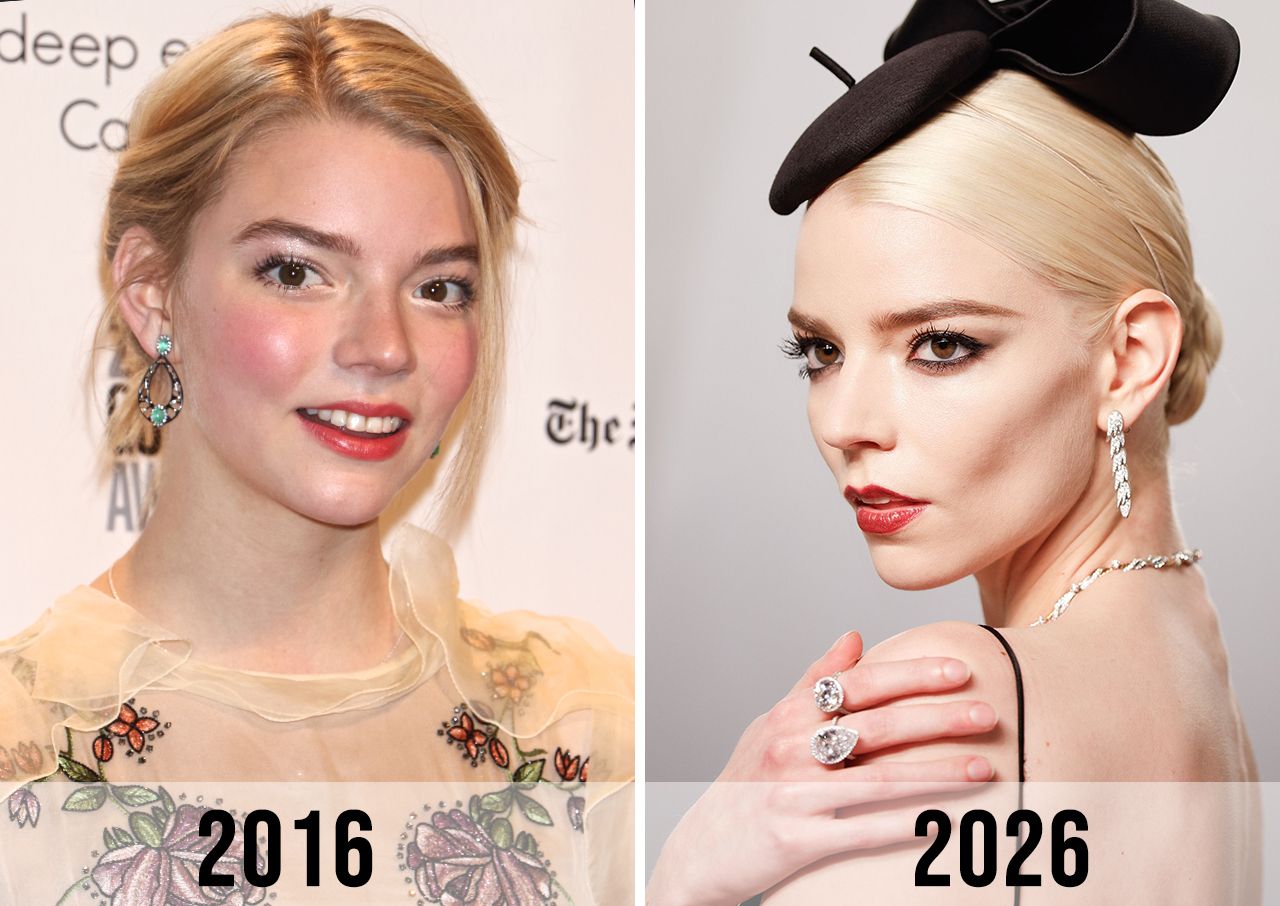 anya-taylor-joy-before-and-after