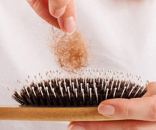 hair loss
