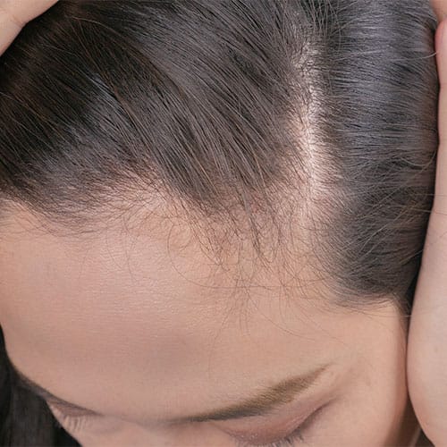 best affordable hair oil thinning hair