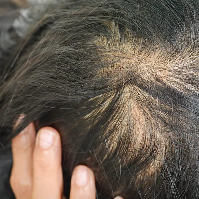 <h3>Why Everyone Loves The Olaplex No. 3 Hair Perfector</h3> best shampoo celebrities use for thinning hair