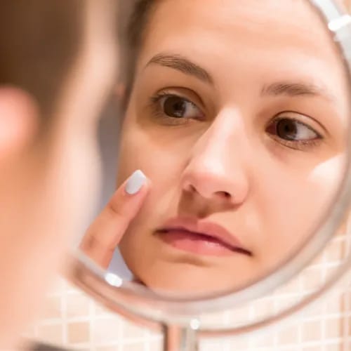 woman applying pimple cream