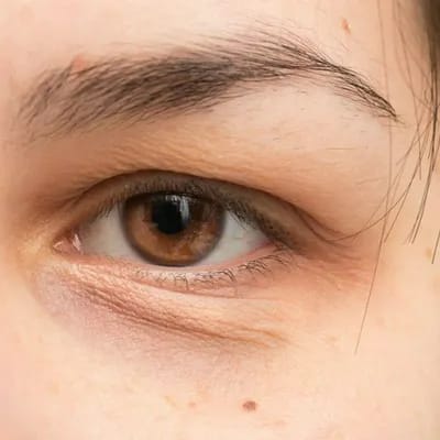 harsh morning cleansers make puffy eyes worse