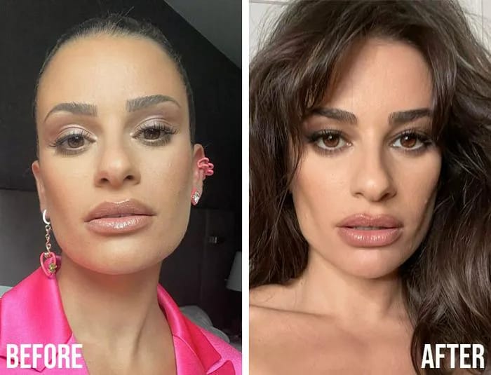 Lea Michele before after buccal fat