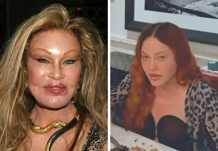 Jocelyn Wildenstein Madonna comparison