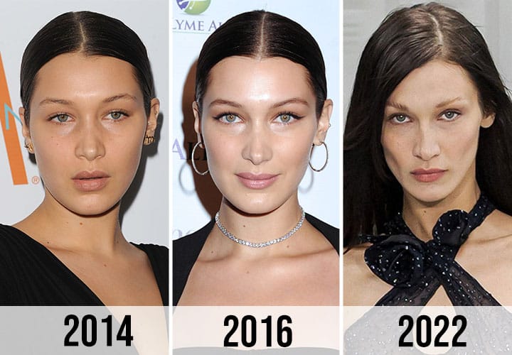 Bella Hadid weight loss pictures