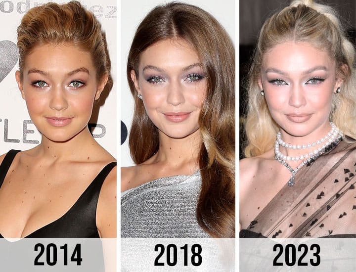 Gigi Hadid face transformation 2014 2018 2023