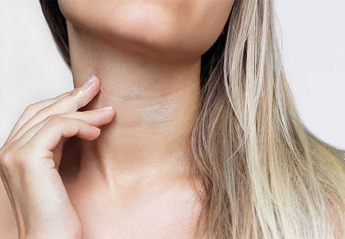 closeup-neck-lines