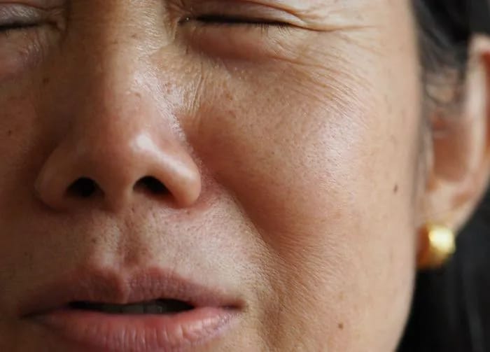 woman-fine-lines-dehydration