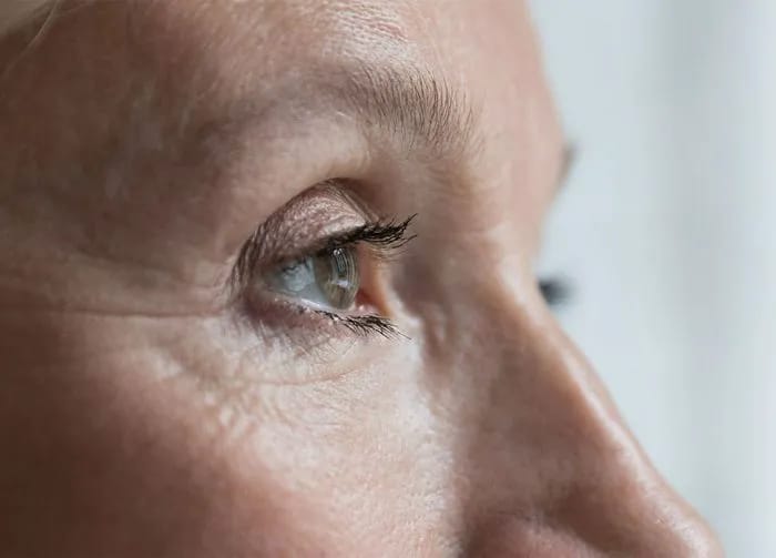 woman-crows-feet