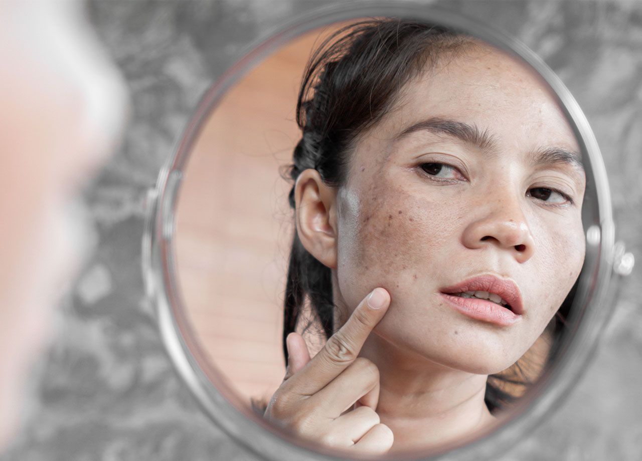 woman-looking-at-skin