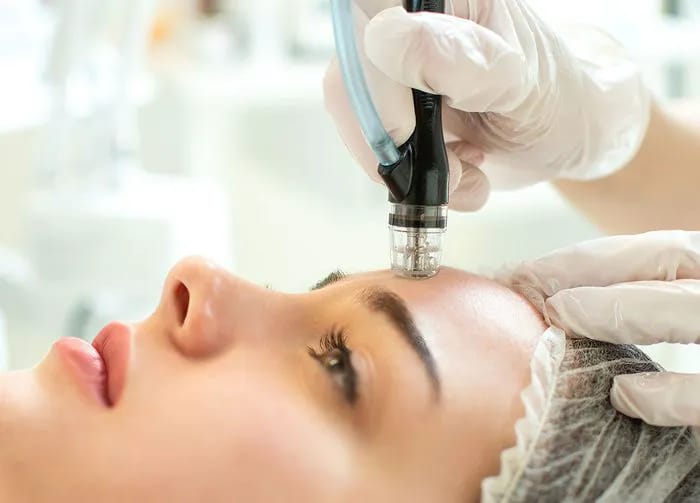 woman-getting-microdermabrasion
