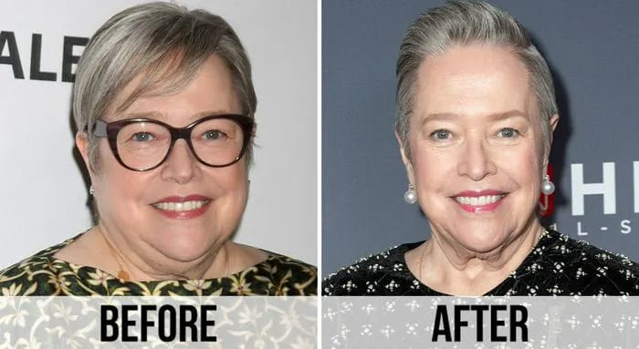 Kathy Bates before and after weight loss face