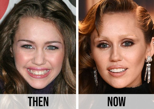 Miley Cyrus before and after
