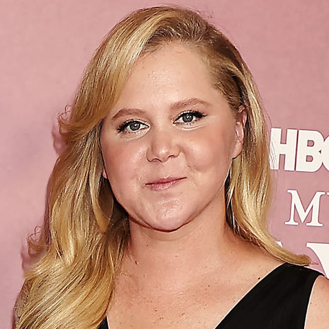 Amy Schumer Flaunts Her 50-Lb Weight Loss On Social Media And Tells Fans  She Did It To 'Survive' Cushing Syndrome: 'I Had A Disease' - SHEfinds