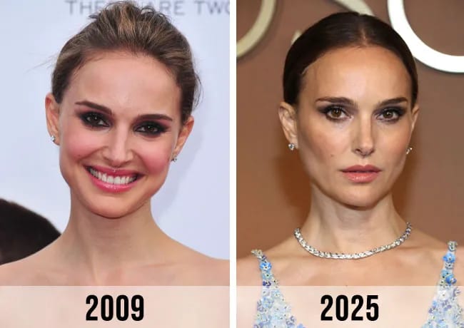 natalie portman plastic surgery Image 2