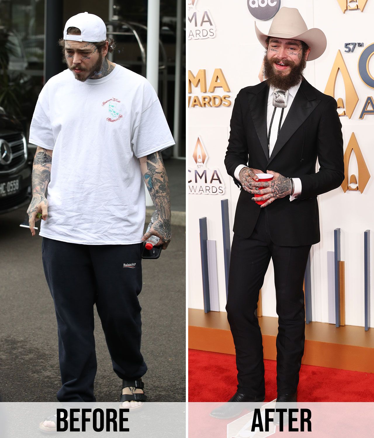 Post Malone Weight Loss Method: Proven Tips for Rapid Results