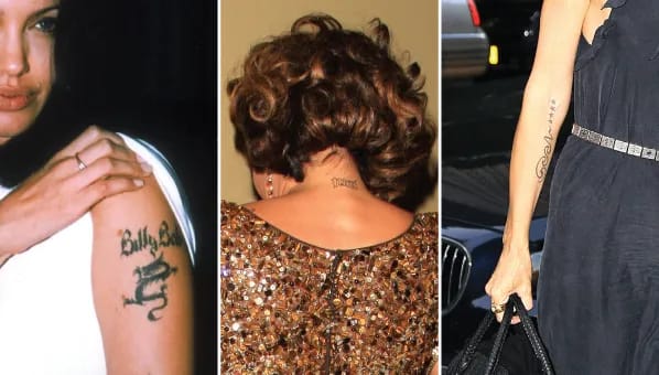 Celebrities who have removed their tattoos.