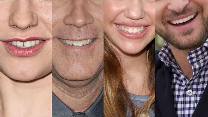 "Celebrity teeth close-up"