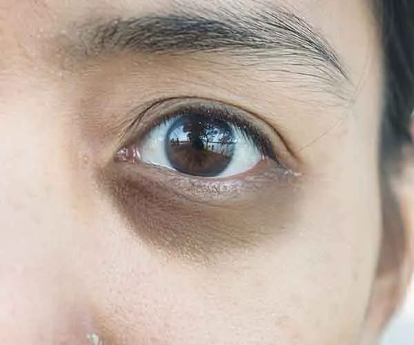 under eye bag product