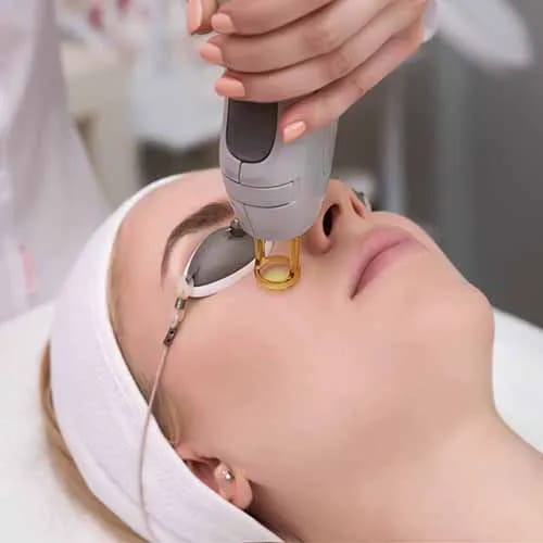 laser treatments