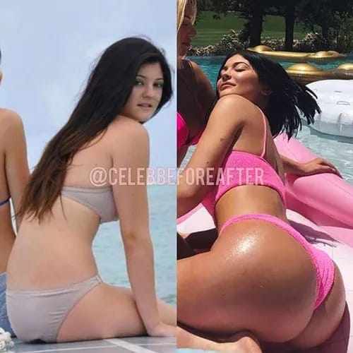 Kylie Jenner