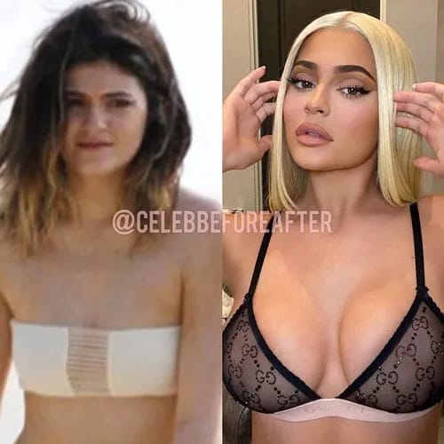 Kylie Jenner