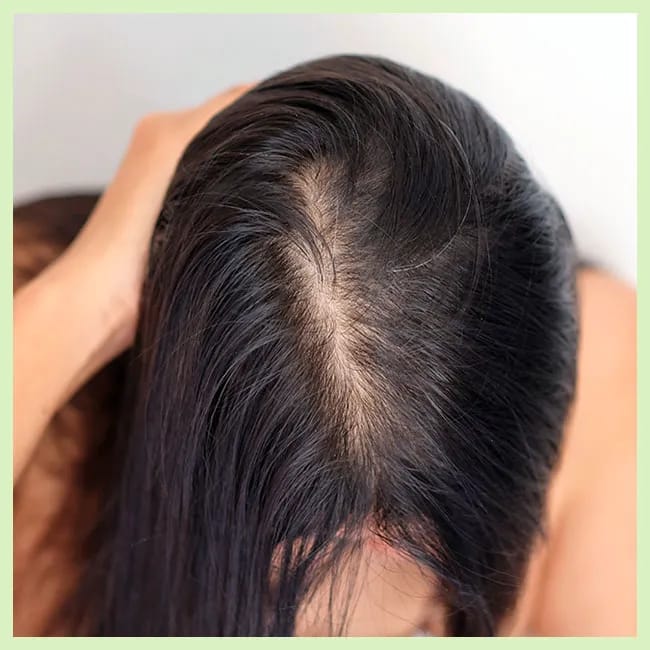 High-protein foods for promoting hair growth.
