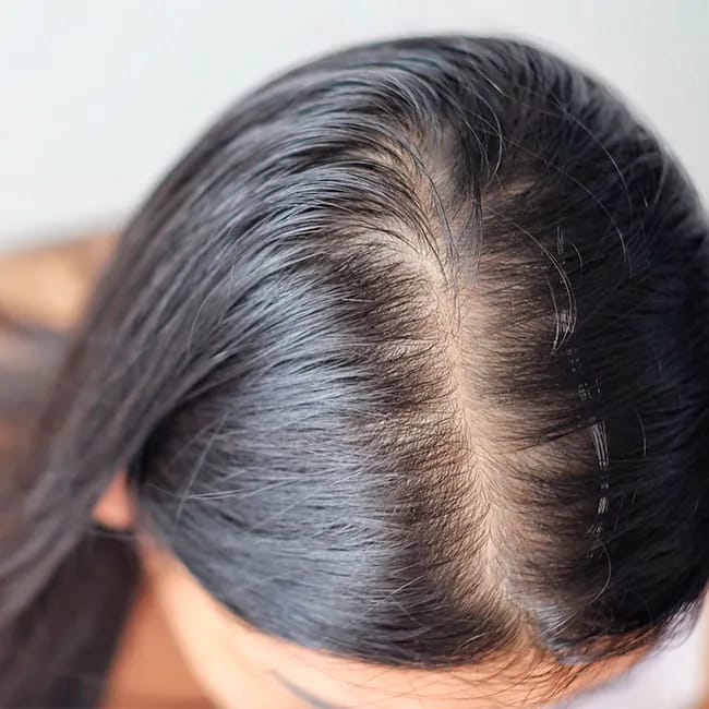 vitamin healthy hair