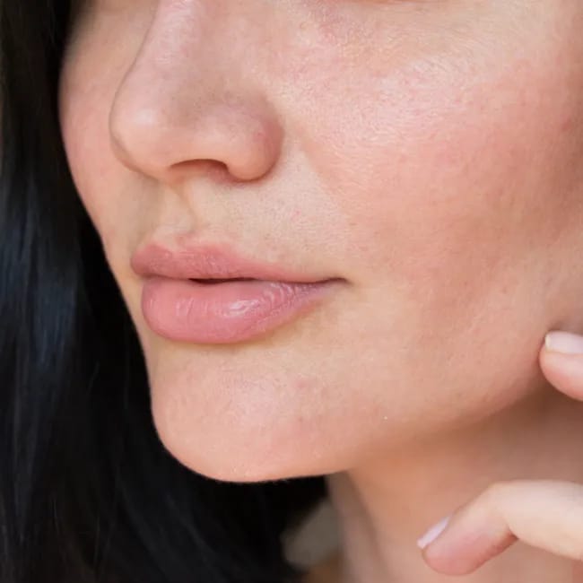 Sulfates worst skincare ingredient dry skin