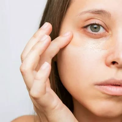 "Woman with dark eye bags"