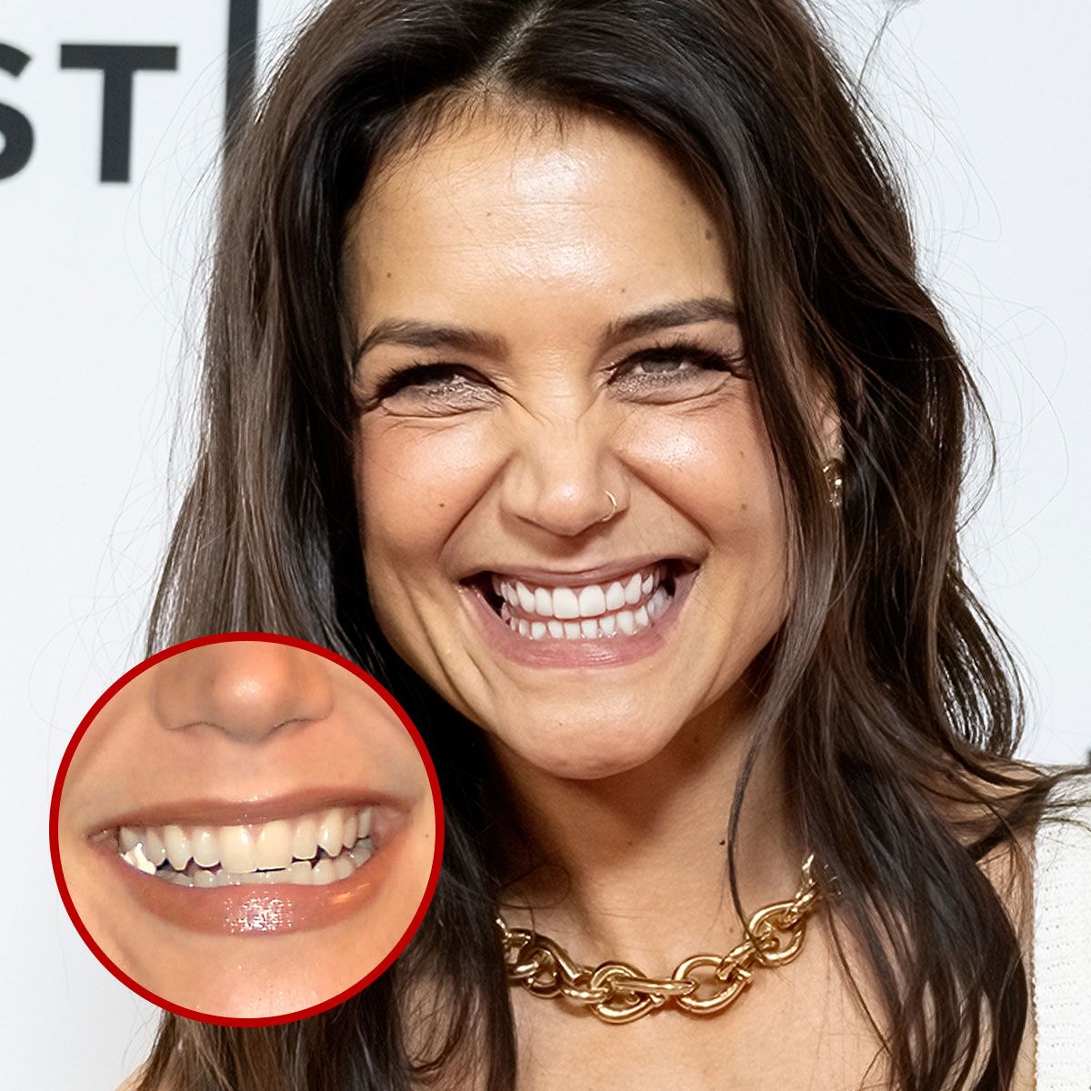 Katie Holmes dental implants before and after transformation.