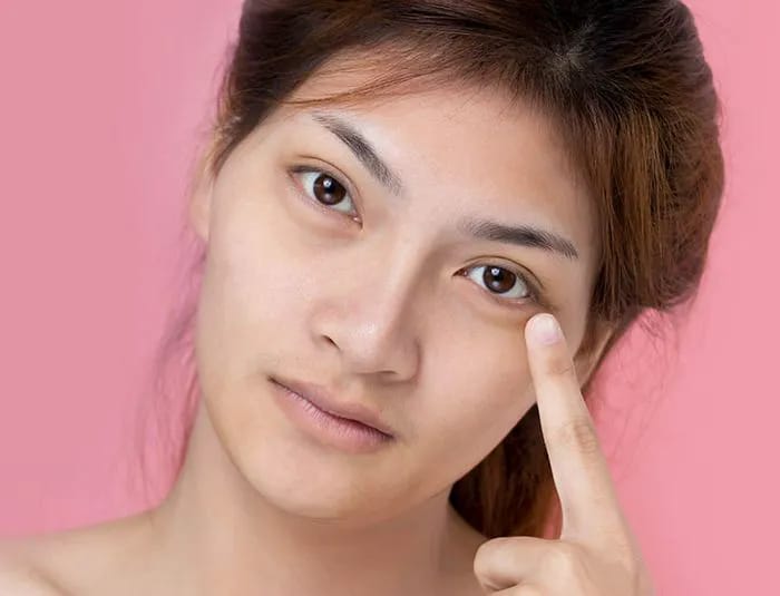 woman-points-at-under-eyes