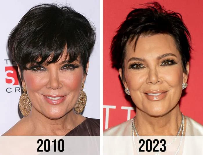Kris Jenner's beauty journey: before and after 2010 to 2023.