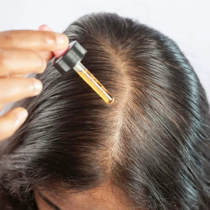 Woman using haircare oil on her scalp