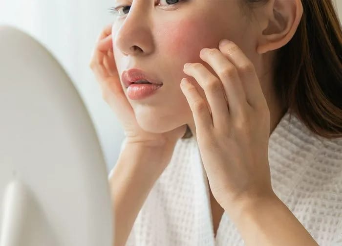 woman-irritated-skin