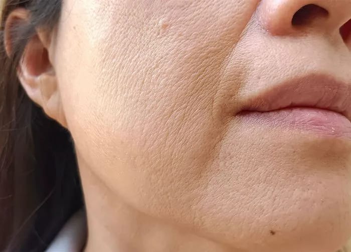 closeup-fine-lines