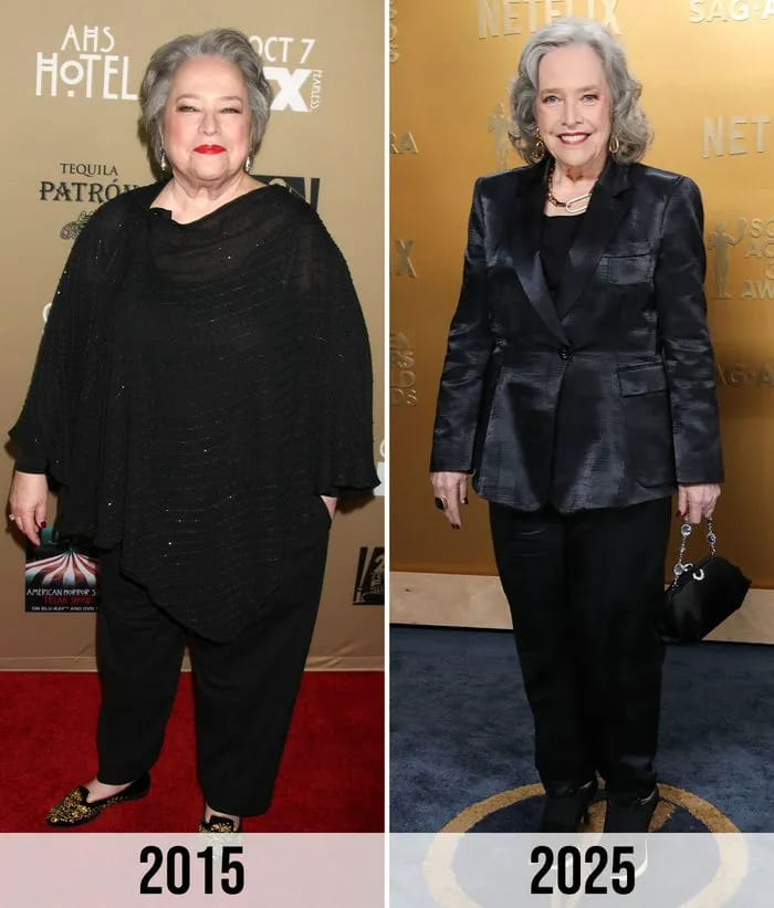 Kathy Bates weight loss 2015 vs 2025 SAG Awards