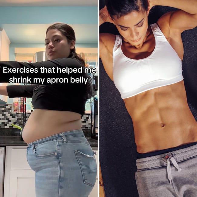 How Do You Get Rid of Apron Belly: Proven Tips That Work Fast